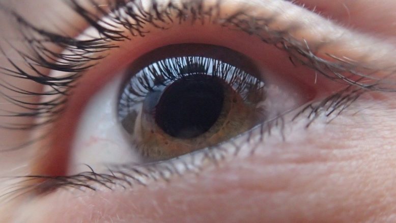 ojo en primer plano que destaca pestañas, pupila, iris y córnea que se afina formando queratocono